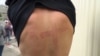 'How Can This Be Our Country?': Claims Of Torture Abound As Belarusian Jails Swell