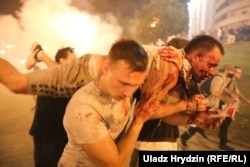 Demonstrators in Minsk carry an injured man during a protest after polls closed in Belarus' presidential election on August 9, 2020.
